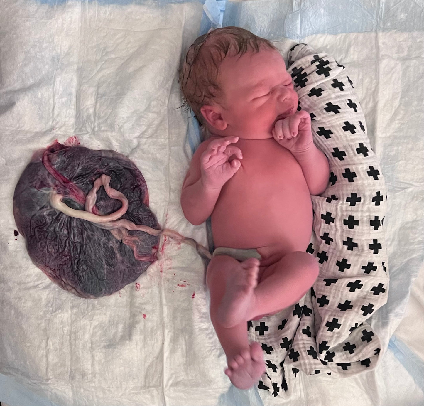 Baby Placenta Lotus birth